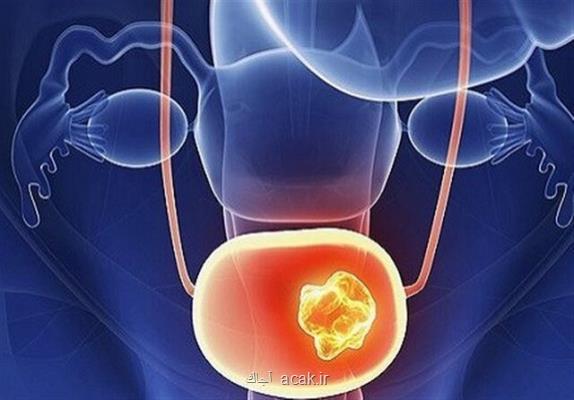 كاهش عفونت های جنسی در دوران انتشار كرونا
