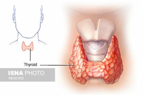 اثر هورمون های تیروئیدی بر بروز فاکتورهای سندروم متابولیک
