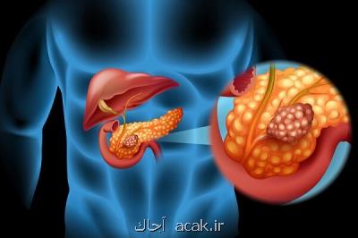 تأثیر بازبرنامه ریزی اپی ژنتیكی سلول های سرطان لوزالمعده بر كاهش تومورزایی آنها